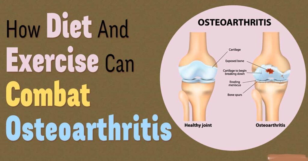 Osteoarthritis And Nutrition Holistic Nutrition Is A Revolutionary