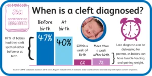 CLEFT PALATE