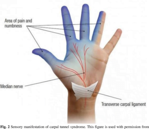 what is the best vitamin for carpal tunnel